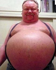 Metabolic Syndrome Metabolic Syndrome